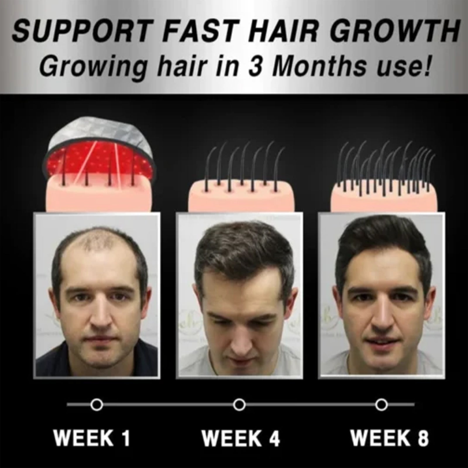 Moving Hair Growth Treatment, Repair Frizzy, Smooth And Dense Hair Scalp Care Heating Massage Cap